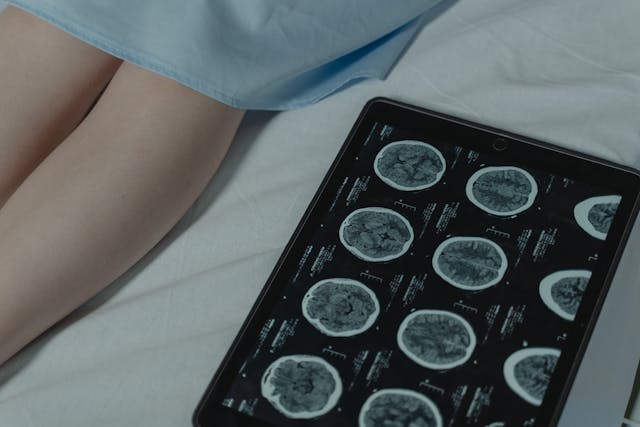 Department Of Neurology