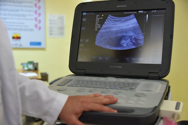  Department of Ultra Sound Scanning
